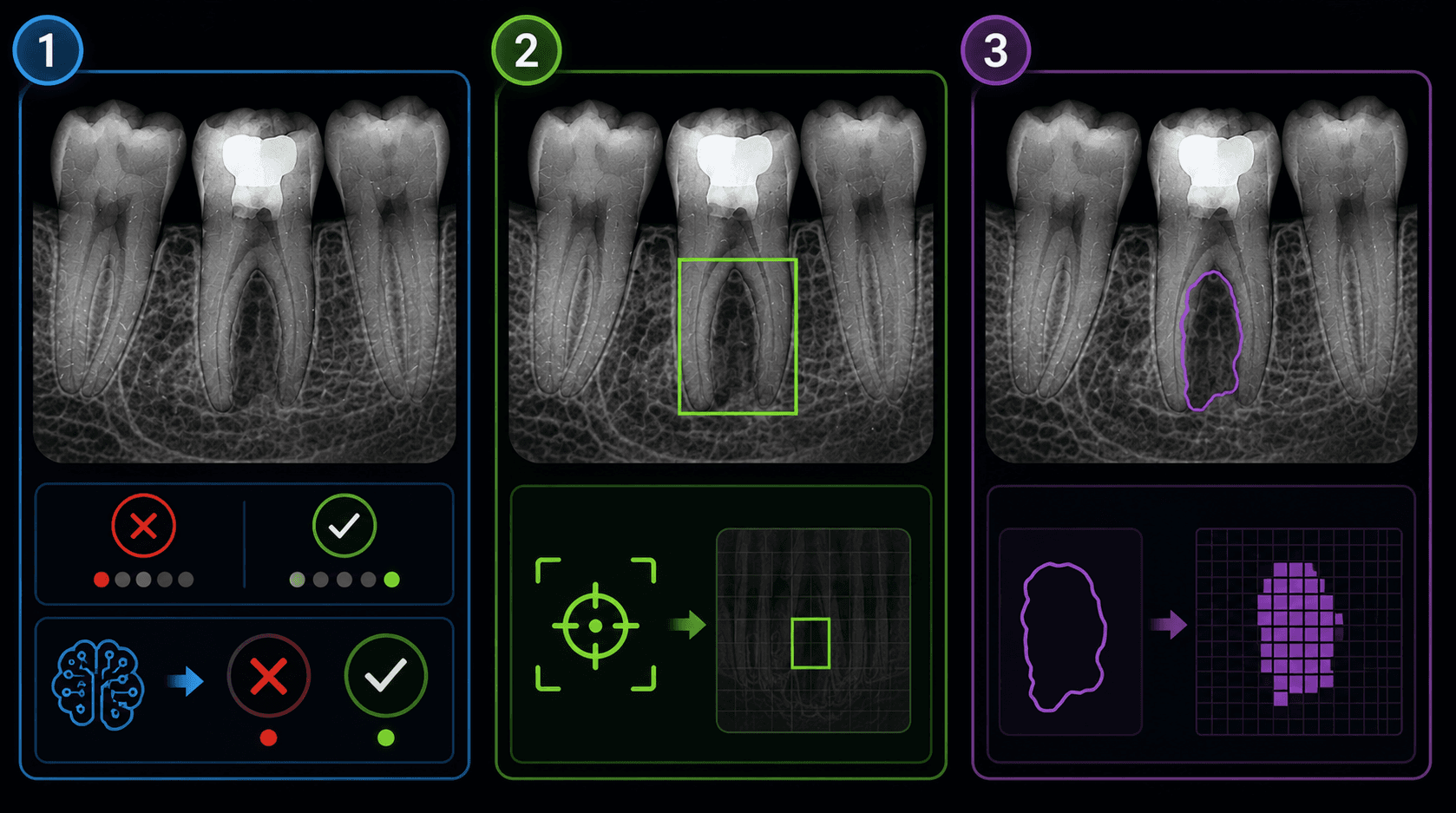 Figura 3 asociada a inteligencia artificial en endodoncia