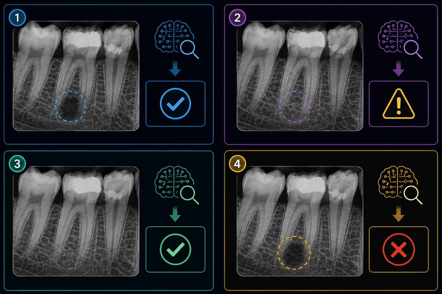 Figura 4 asociada a inteligencia artificial en endodoncia