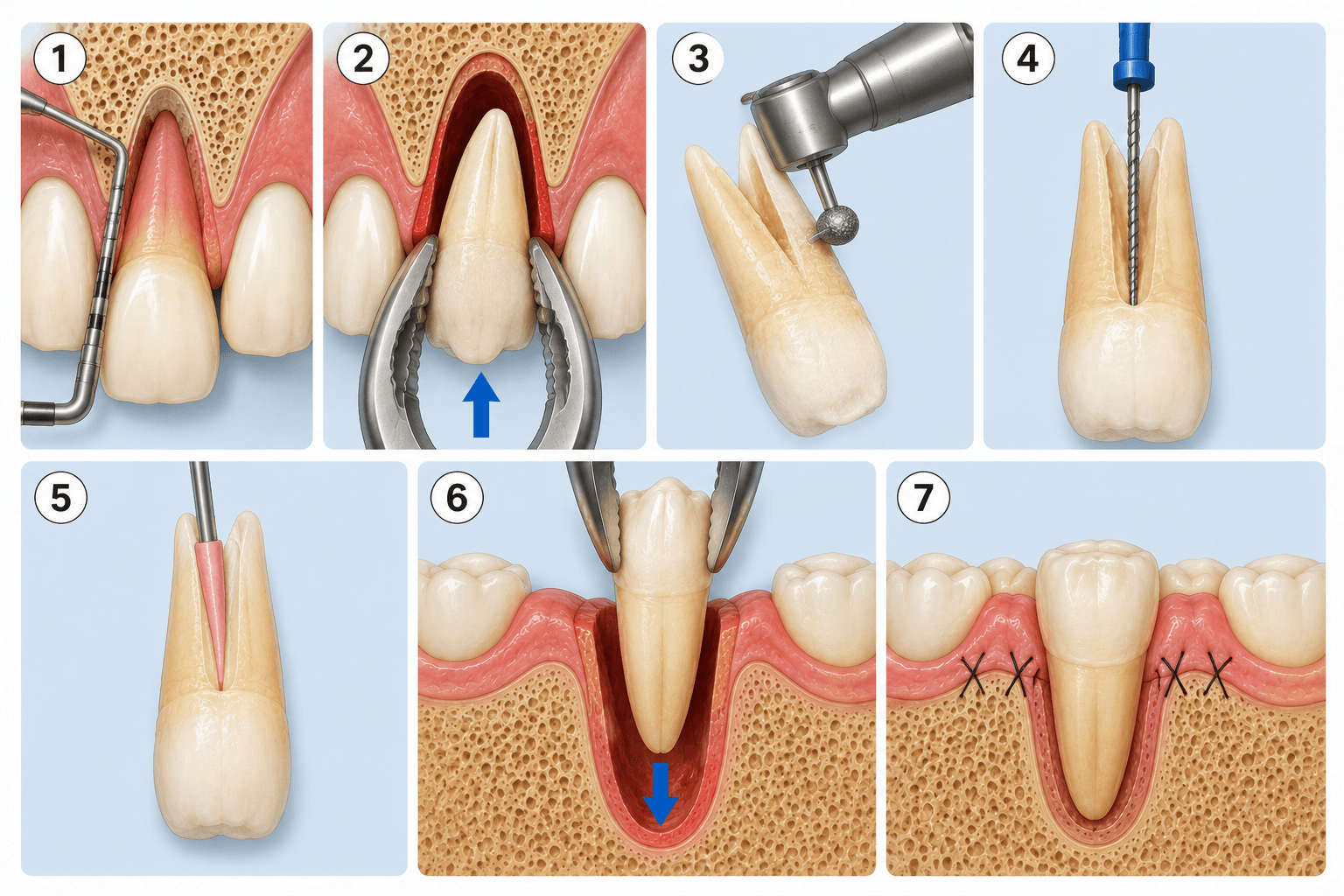 Figura 2 asociada a reimplante dental intencional