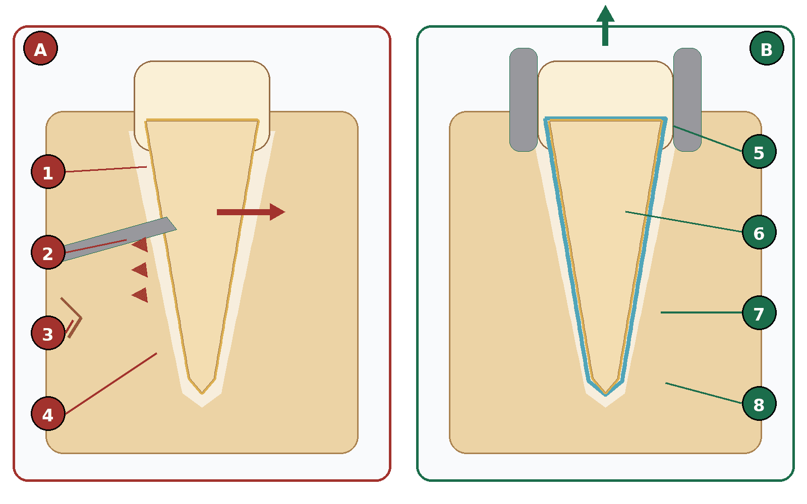 Figura 6 asociada a reimplante dental intencional