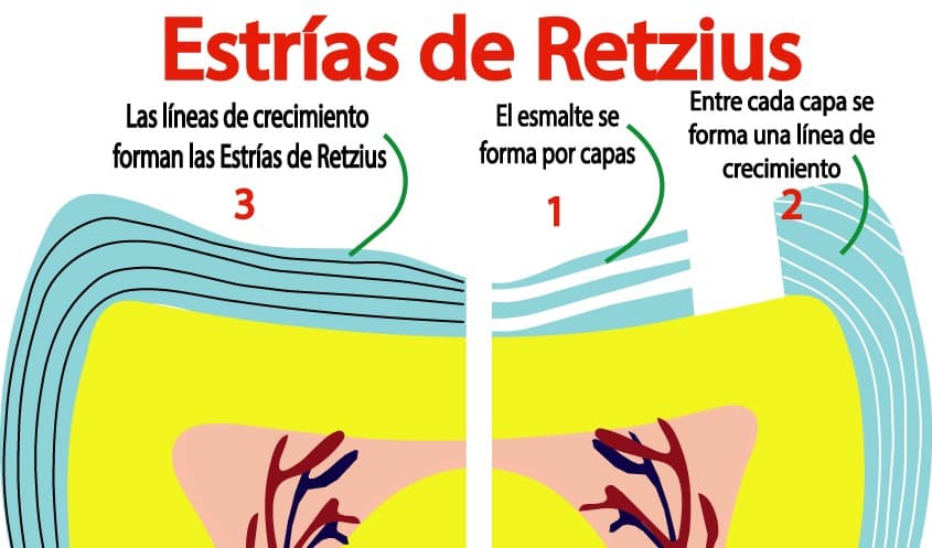Estrías de Retzius