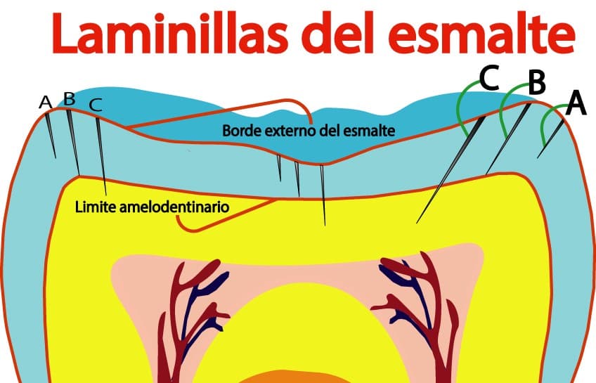 Laminillas del esmalte