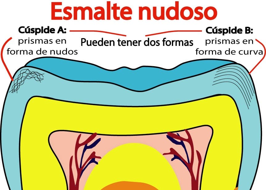 Esmalte nudoso