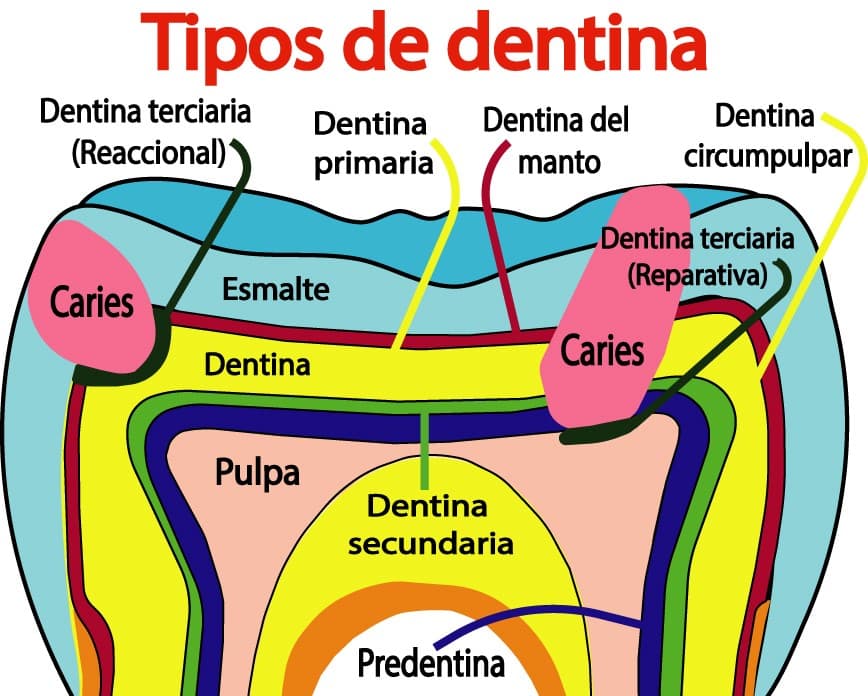 Tipos de dentina según su desarrollo