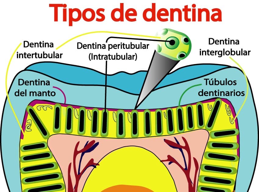 Tipos de dentina según localización y mineralización