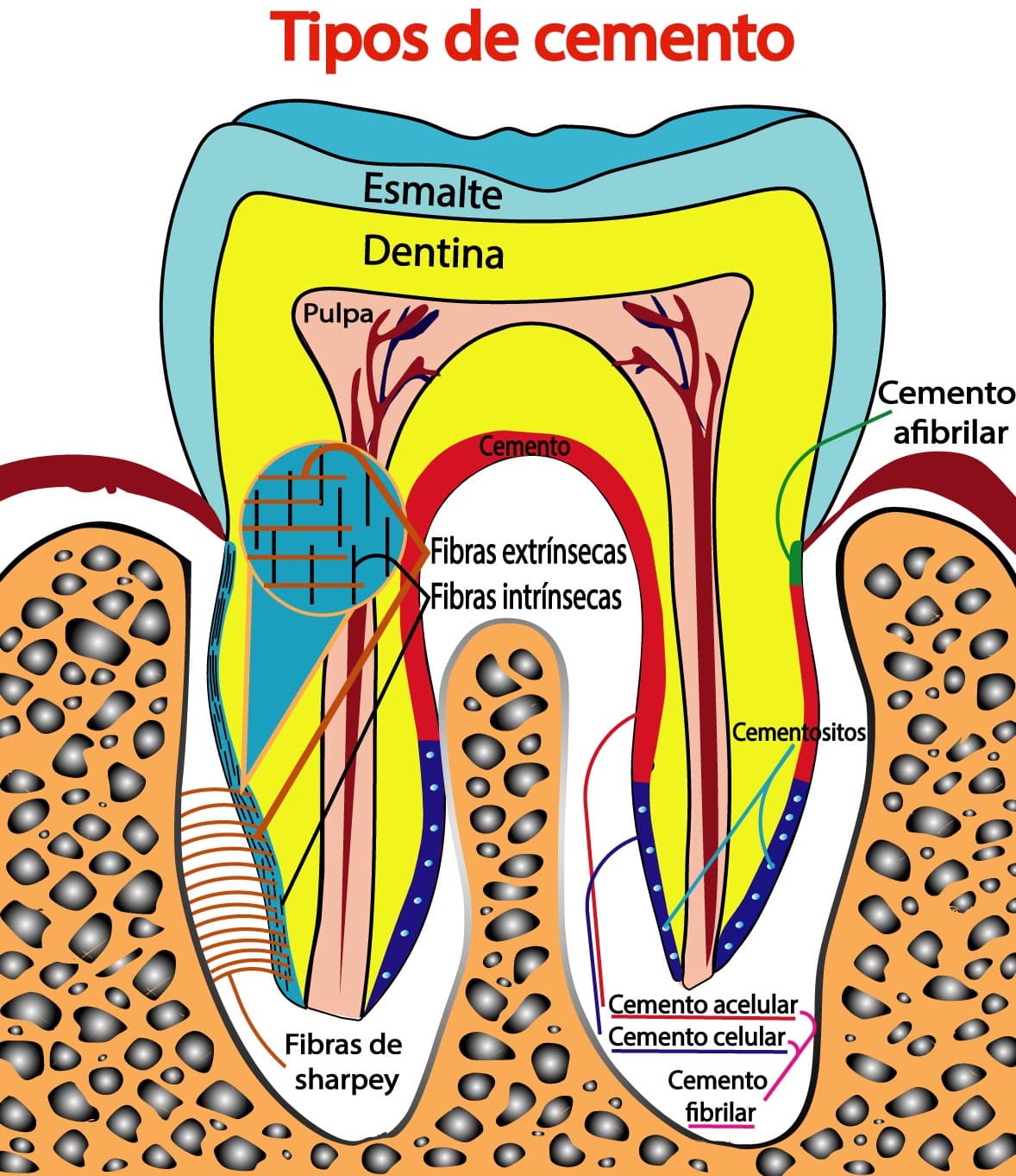 Tipos de cemento dentario