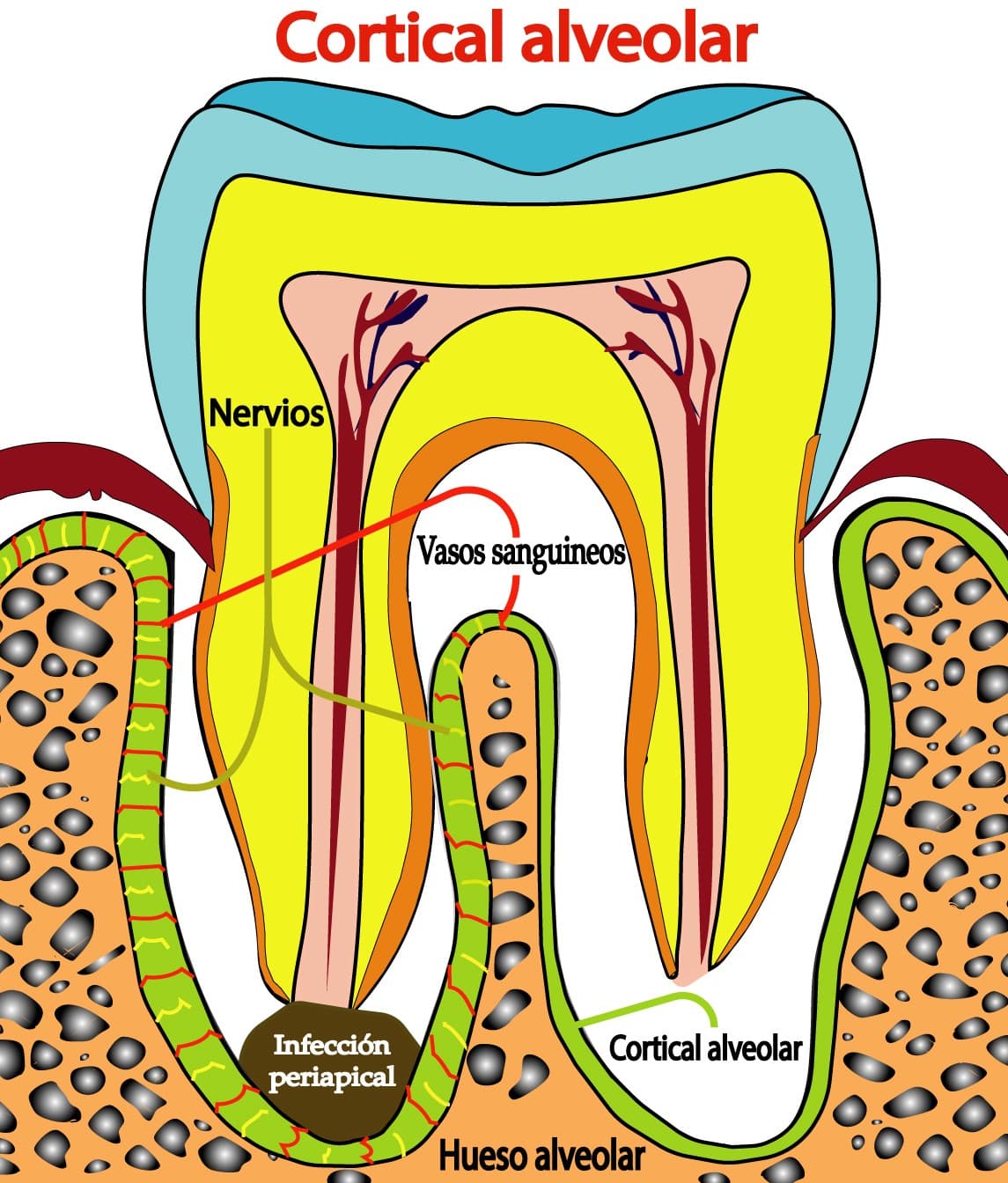 Cortical alveolar