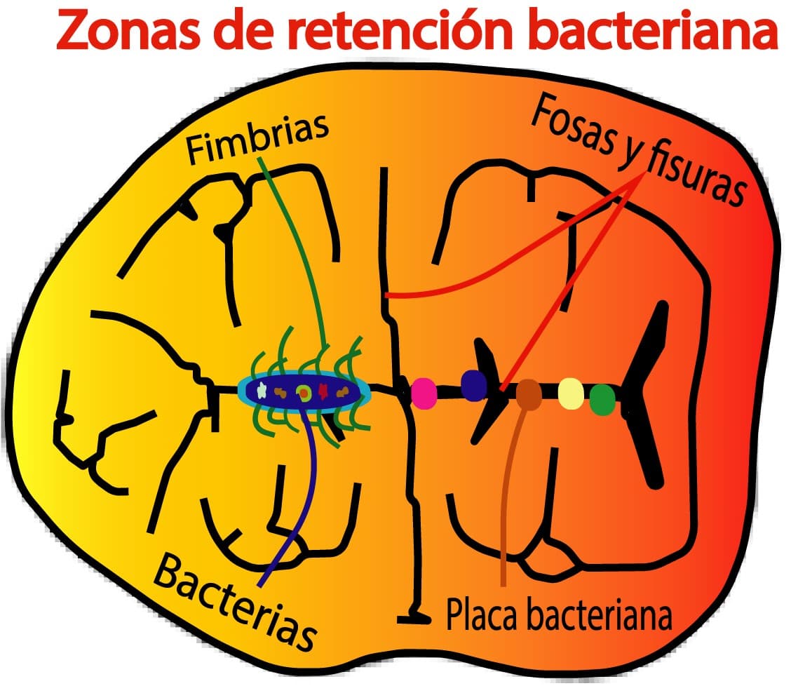 Zonas de retención bacteriana
